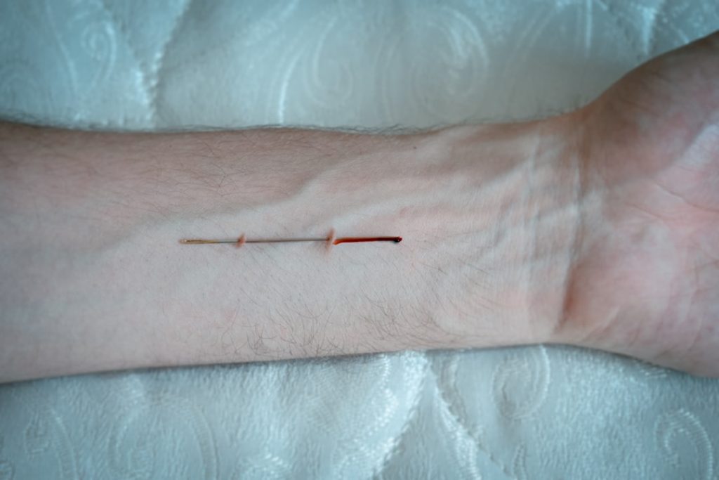 implantationsblutung: ursachen, symptome und was sie wissen müssen, wenn leichte blutungen während der frühen schwangerschaft auftreten.