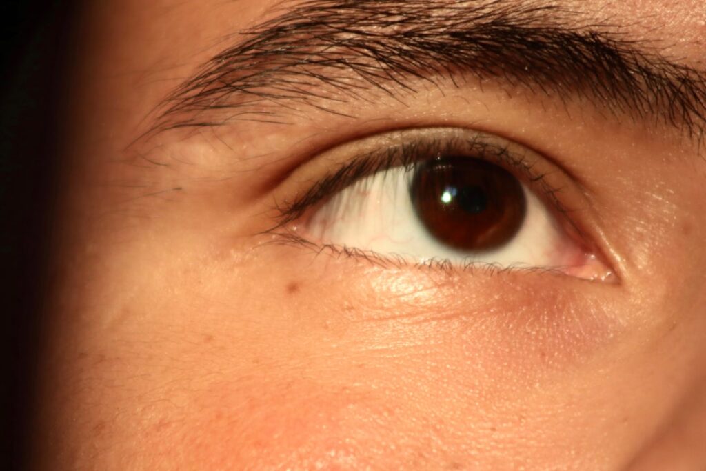 konjunktivitis ist eine entzündung der bindehaut des auges, die rötung, juckreiz und ausfluss verursacht. erfahren sie mehr über ursachen, symptome und behandlungsmöglichkeiten.